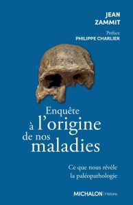 Enquête sur l'origine de nos maladies. Ce que nous révèle la paléopathologie - Zammit Jean - Charlier Philippe