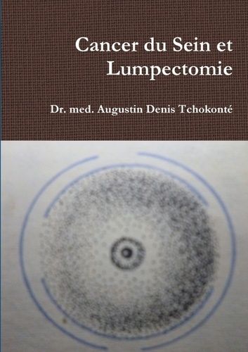 Emprunter Cancer du Sein et Lumpectomie livre