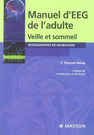 Emprunter Manuel d'électroencéphalogramme de l'adulte livre