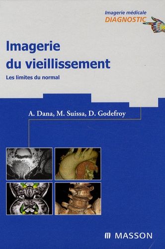 Emprunter Imagerie du vieillissement. Les limites du normal livre