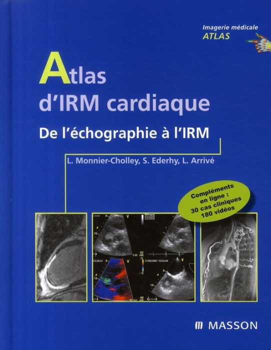 Emprunter Atlas d'imagerie cardiaque. De l'échographie à l'IRM livre