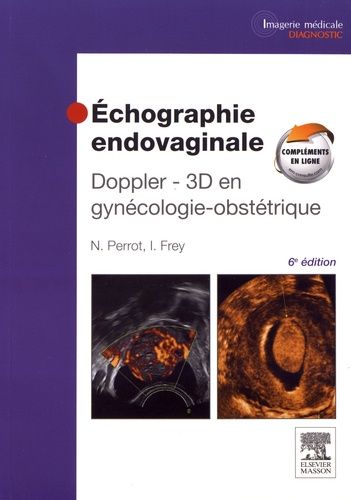 Emprunter Echographie endovaginale. Doppler-3D en gynécologie-obstétrique, 6e édition livre
