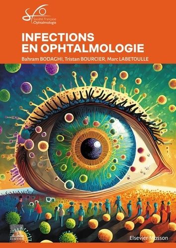 Emprunter Infections en ophtalmologie. Rapport SFO 2024 livre