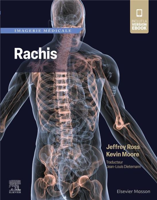 Emprunter Imagerie médicale : Rachis livre