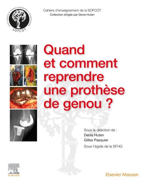 Emprunter Quand et comment reprendre une prothèse de genou ? livre