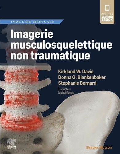 Emprunter Imagerie musculosquelettique non traumatique livre