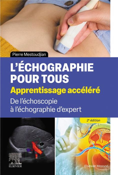 Emprunter L'échographie pour tous : apprentissage accéléré. De l'échoscopie à l'échographie d'expert, 2e éditi livre