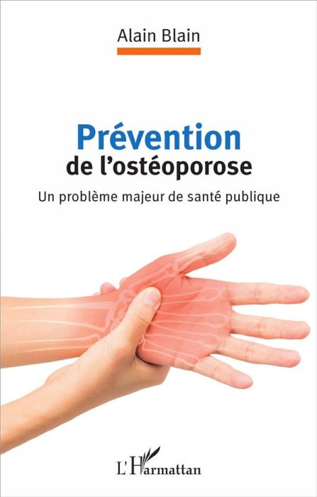 Emprunter Prévention de l'ostéoporose. Un problème majeur de santé publique livre