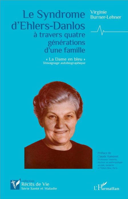 Emprunter Le Syndrome d'Ehlers-Danlos à travers quatre générations d'une famille. 