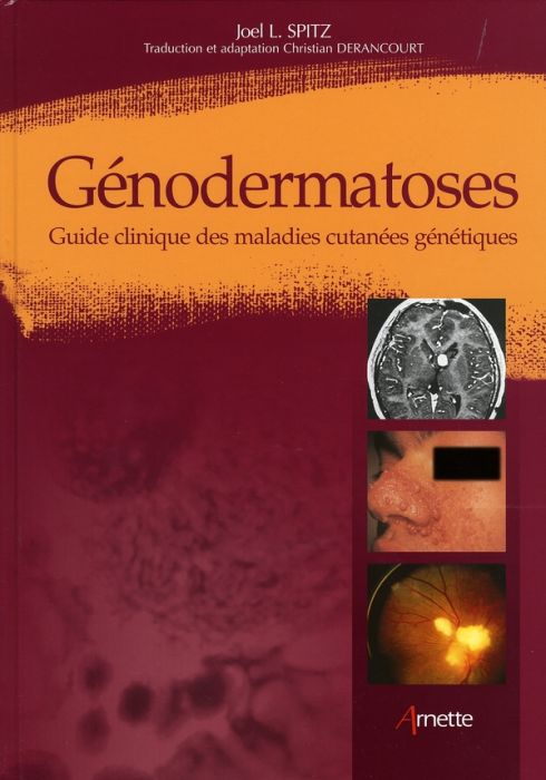 Emprunter Génodermatoses. Guide clinique des maladies cutanées génétiques livre