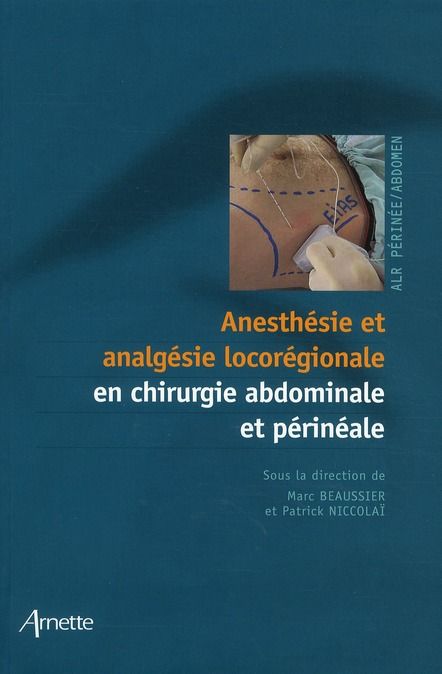 Emprunter Anesthésie et analgésie locorégionale en chirurgie abdominale et périnéale livre