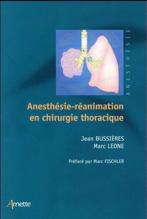 Emprunter Anesthésie-réanimation en chirurgie thoracique livre