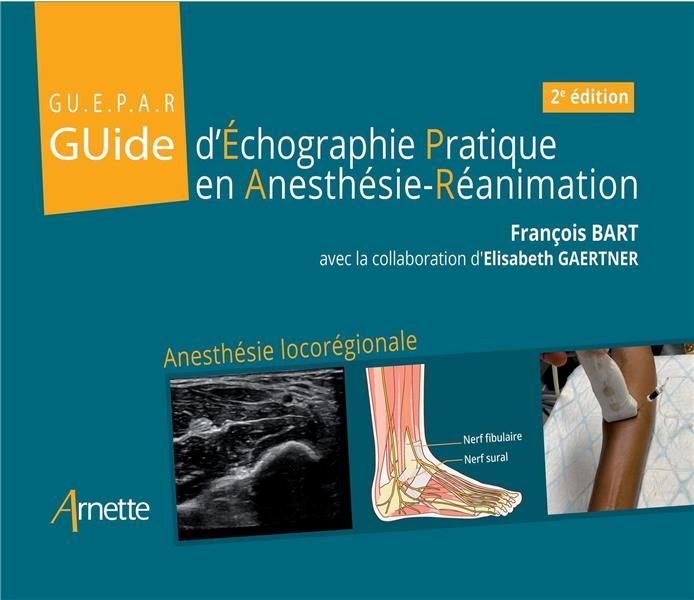 Emprunter Guide d'échographie pratique en anesthésie-réanimation. 2e édition livre