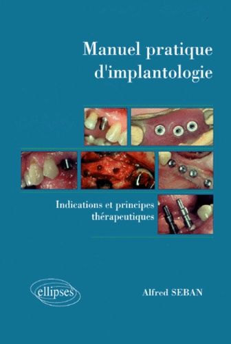 Emprunter MANUEL PRATIQUE D'IMPLANTOLOGIE. Indications et principes thérapeutiques livre