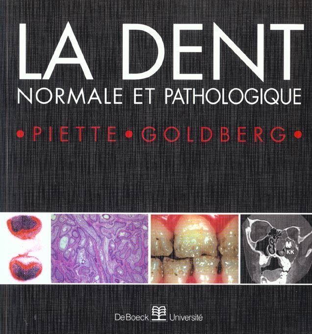 Emprunter La dent normale et pathologique livre