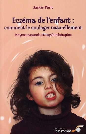 Emprunter Eczéma de l'enfant : comment le soulager naturellement. Moyens naturels et psychothérapies livre