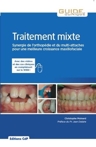 Emprunter Traitement mixte. Synergie de l'orthopédie et du multi-attaches pour une meilleure croissance maxill livre