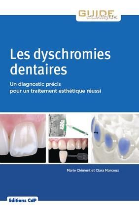 Emprunter Les dyschromies dentaires. Un diagnostic précis pour un traitement esthétique réussi livre