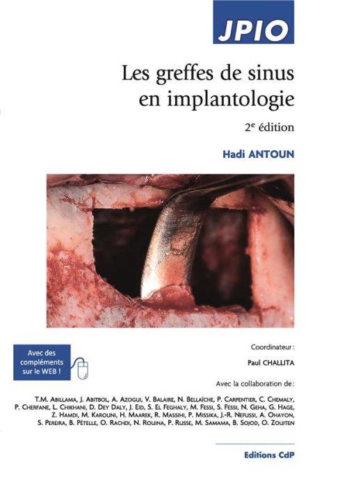 Emprunter Les greffes de sinus en implantologie. 2e édition livre