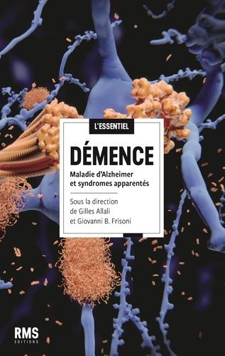 Emprunter Démence. Maladie d'Alzheimer et syndromes apparentés livre