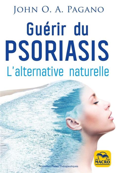 Emprunter Guérir du psoriasis. L'alternative naturelle livre