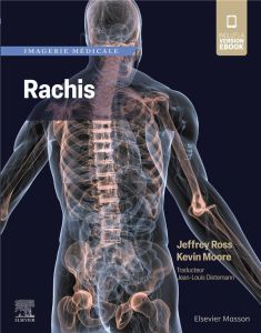 Imagerie médicale : Rachis - Ross Jeffrey - Moore Kevin - Dietemann Jean-Louis